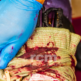 Tactical Emergency Casualty Care (TECC and TCCC) Related Stock - Editorial Photos Category Tactical Emergency Casualty Care (TECC and TCCC) Related Stock - Editorial Photos Category